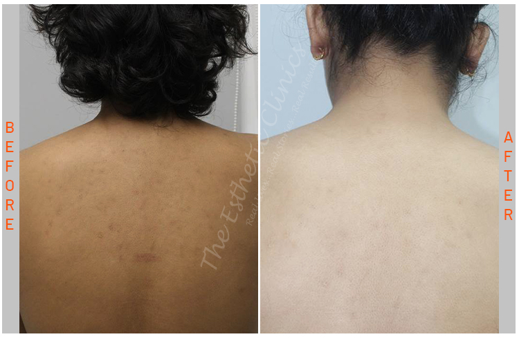 Esthetic Body Brite 